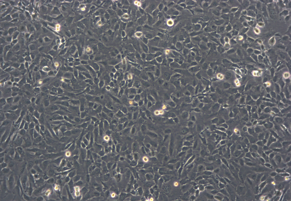 人膀胱移行细胞癌细胞T24(STR鉴定正确)