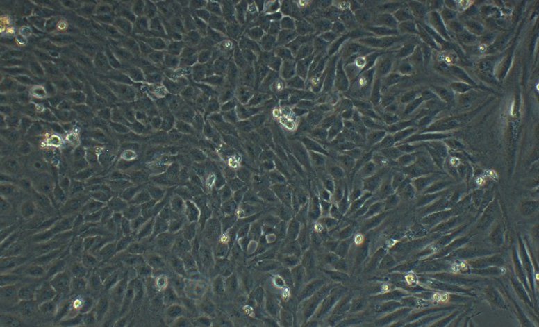 人肝细胞HL-7702[L-02](STR鉴定正确)