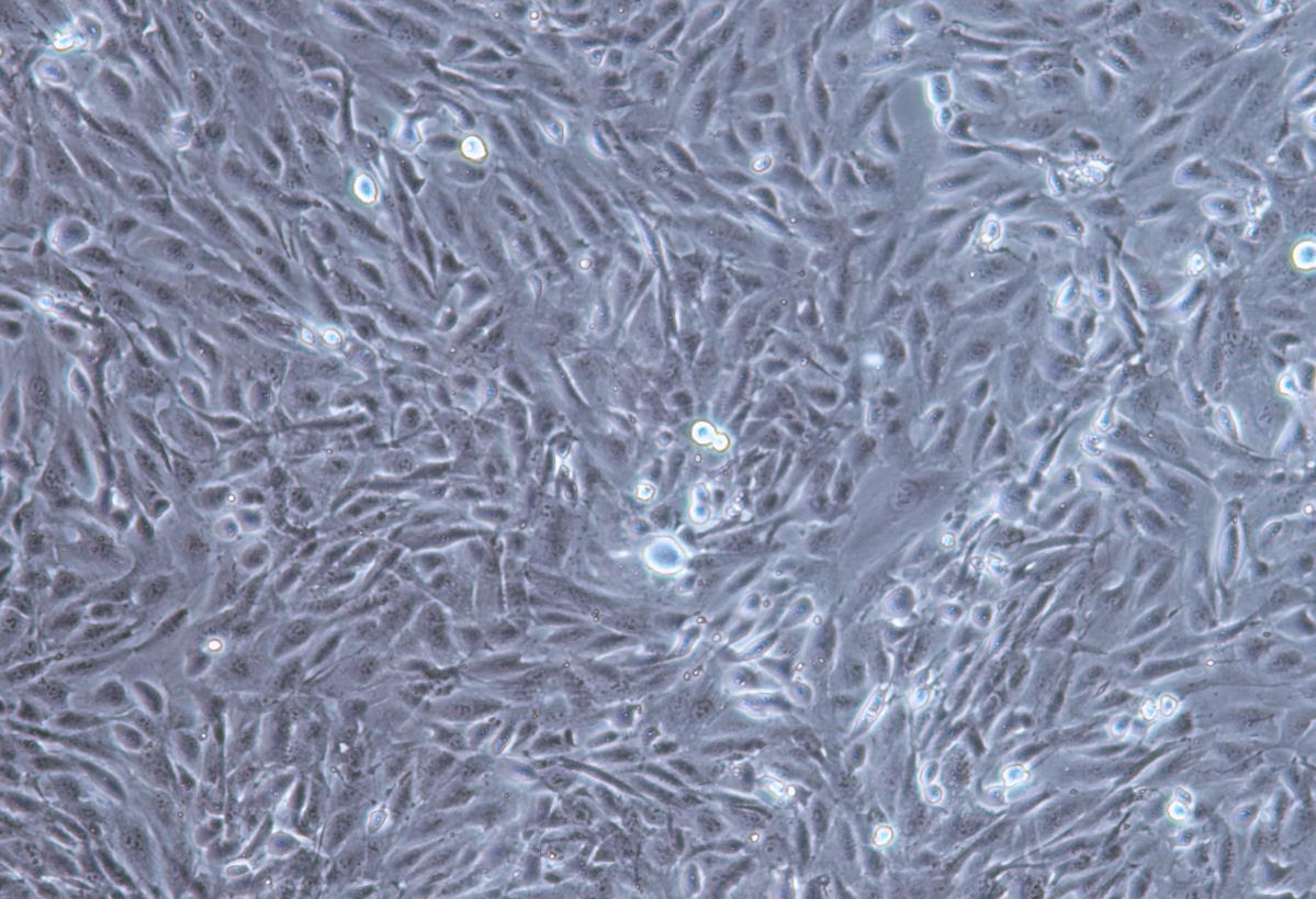 人肾透明细胞腺癌细胞786-O(STR鉴定正确)