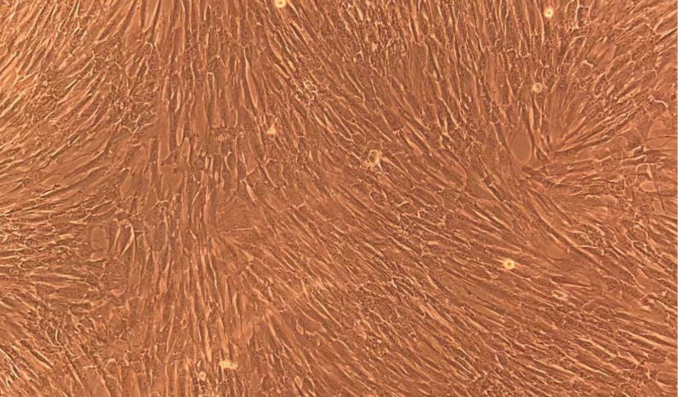 人羊膜间充质干细胞 