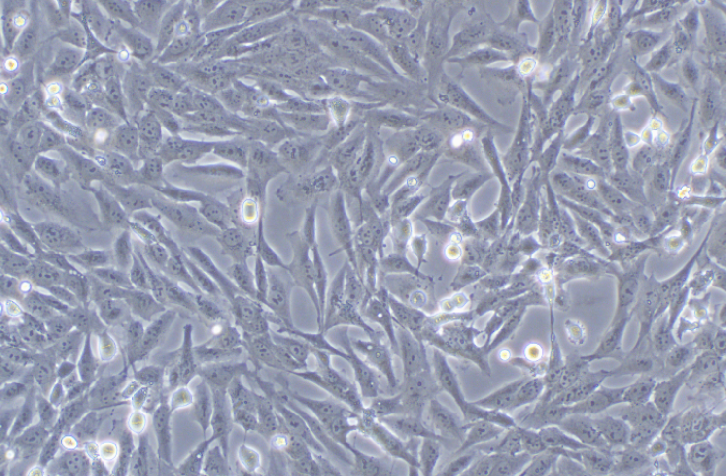人肾小管上皮细胞HK-2(STR鉴定正确)